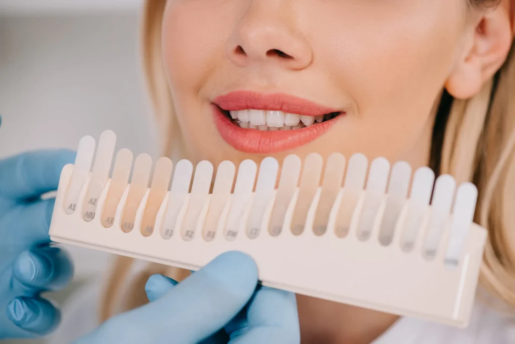 Teeth whitening options: Professional vs. at-home treatments