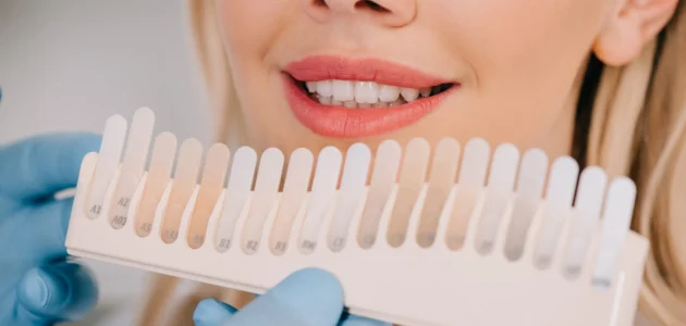 Teeth whitening options: Professional vs. at-home treatments