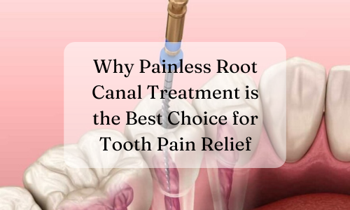 Why Painless Root Canal Treatment is the Best Choice for Tooth Pain Relief