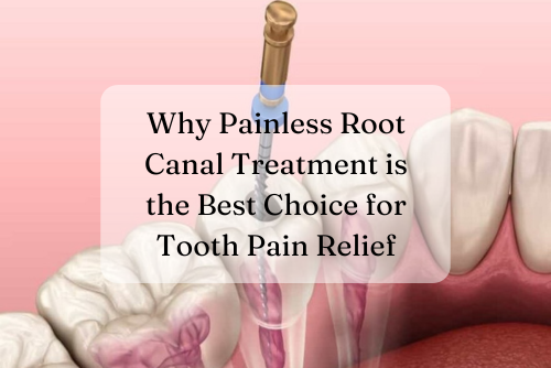 Painless Root Canal Treatment