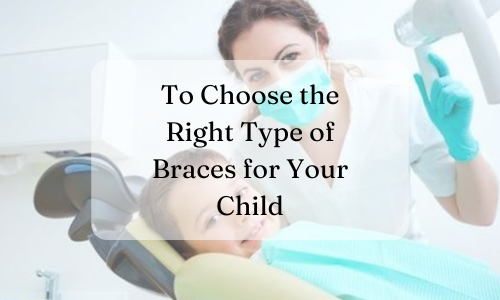 How to Choose the Right Type of Braces for Your Child?